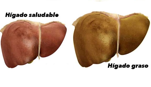 higado-graso-fruta