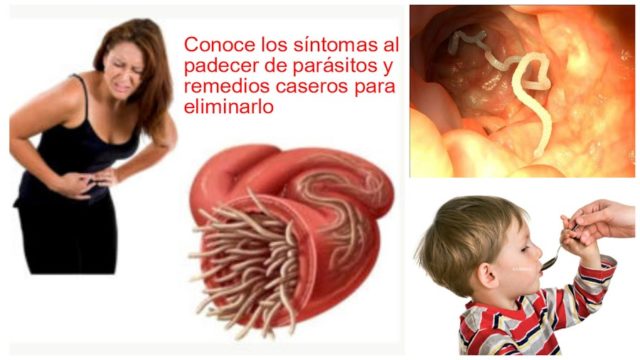 sintomas-de-tener-parasitos-remedios-caseros-1